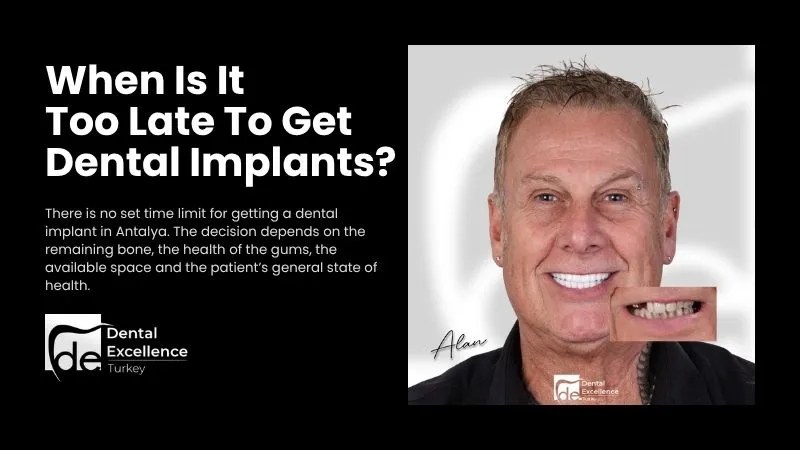Dental implant treatment timing
